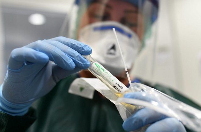 Nurse Canan Emcan shows a test kit for coronavirus samples at the isolation ward of the Uniklinikum Essen university hospital in Essen, western Germany, on March 9, 2020. - The number of coronavirus cases in Germany has passed 1,000, official data from the Robert Koch Institute disease control centre showed. (Photo by INA FASSBENDER / AFP) (Photo by INA FASSBENDER/AFP via Getty Images)
