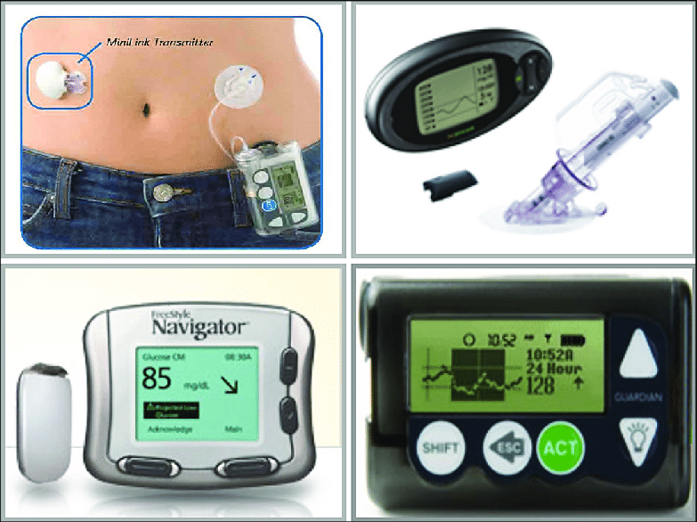 The MiniMed Paradigm REAL-Time (Medtronic Diabetes), DexCom SEVEN (top... |  Download Scientific Diagram